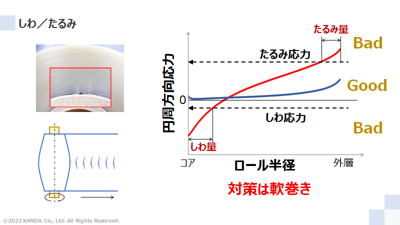 しわと弛みについて