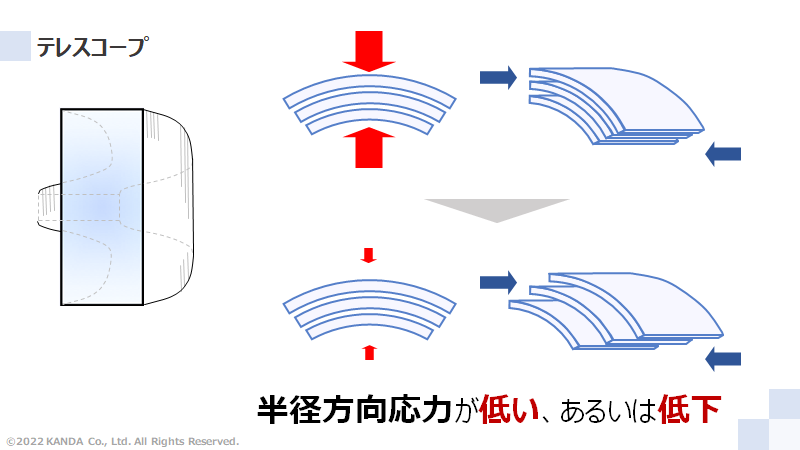 テレスコープと半径方向応力の関係